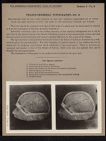 Cranio-Cerebral Topography - no. 9